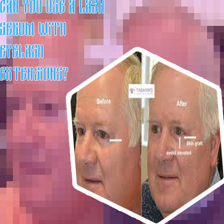 Orbital fat loss lash serum